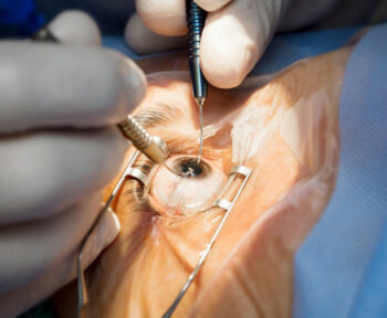  Safeguarding Sight: The Crucial Role of Ophthalmic Instruments in Eye Surgeries