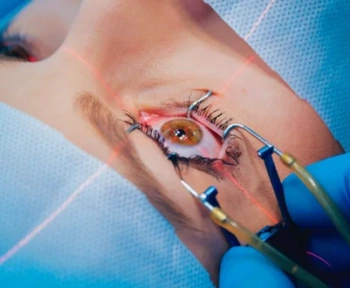 A Closer Look at the Most Common Retina Surgery Instruments and Their Uses